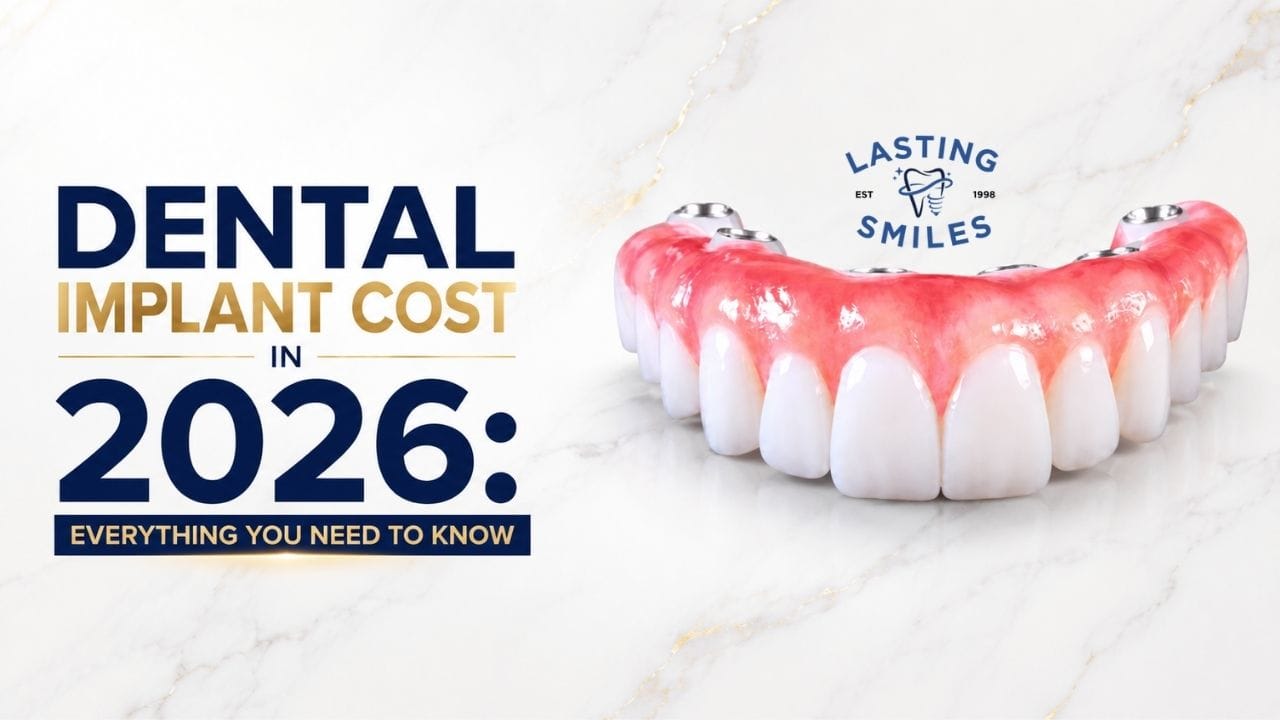 Featured image for “Dental Implant Cost in 2026: The Complete Guide to Pricing, Financing & Hidden Costs”
