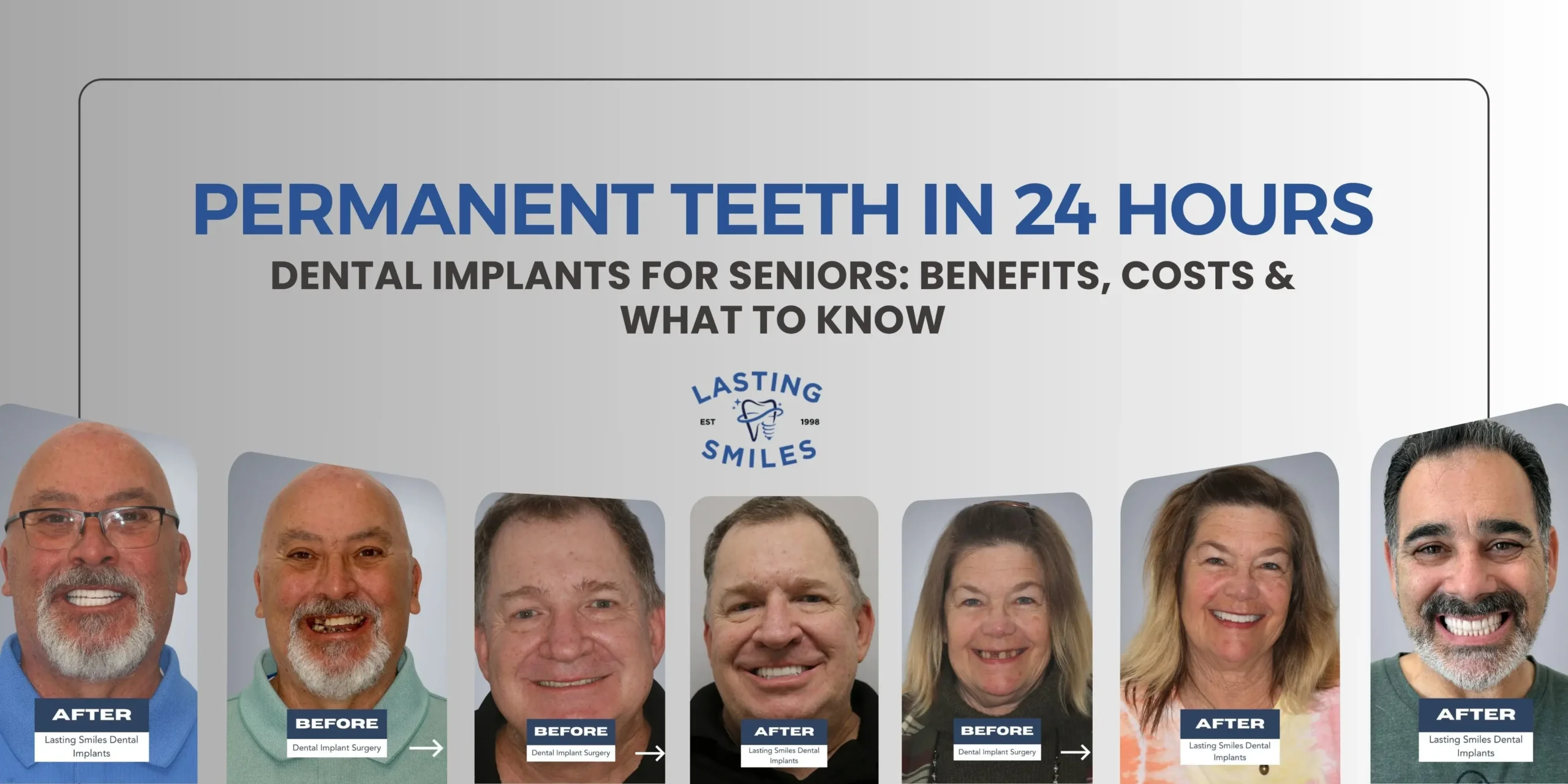 Featured image for “Dental Implants for Seniors: Benefits, Risks & What to Know”