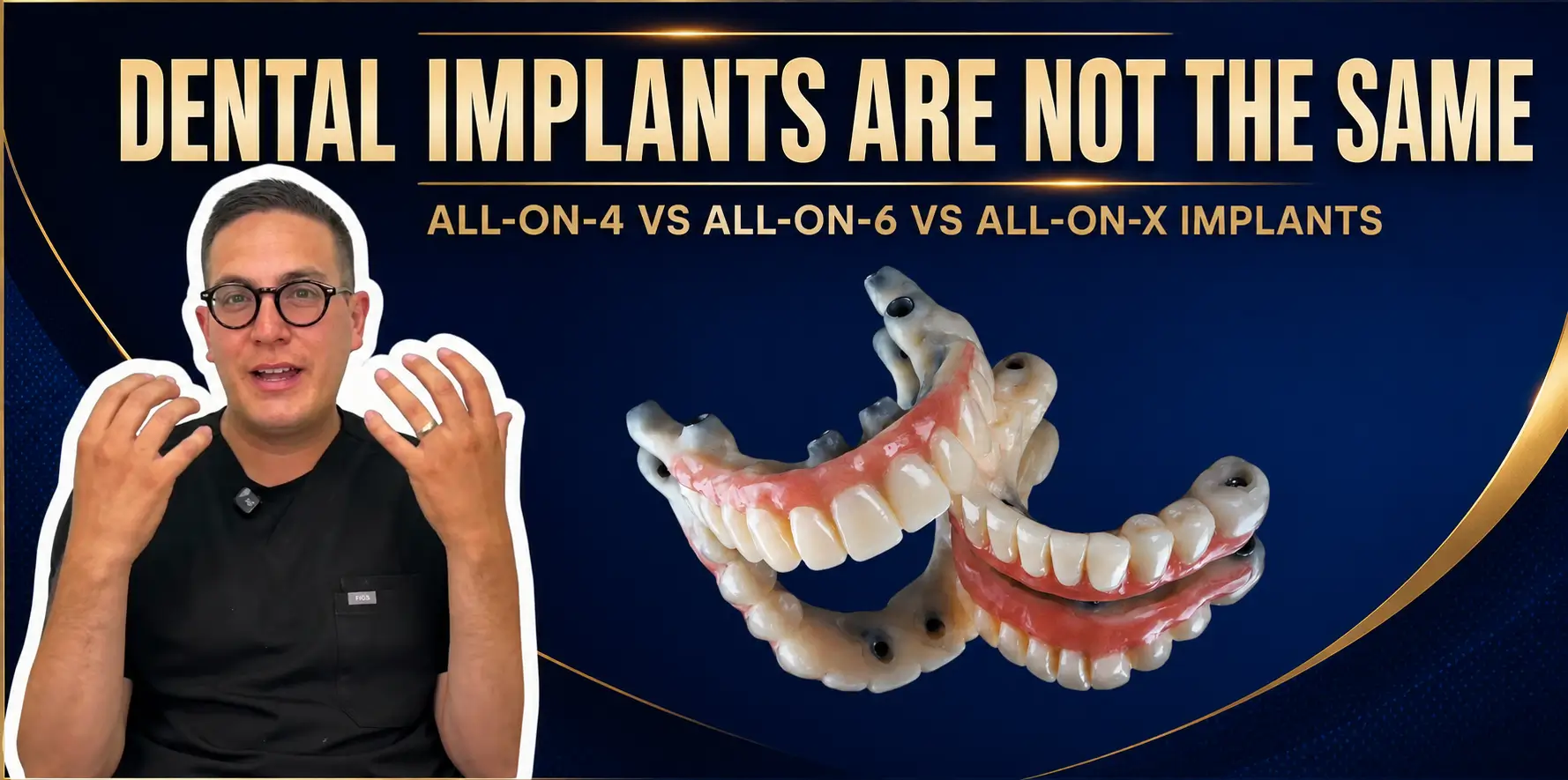 Featured image for “All-on-4 vs All-on-6 vs All-on-X Dental Implants: Which Full-Arch Option Is Right for You?”