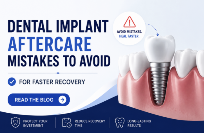 Featured image for “Dental Implant Aftercare Mistakes to Avoid for Faster Recovery”