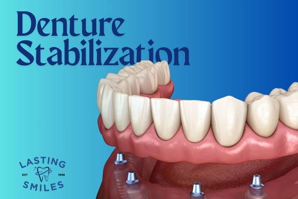 Featured image for “Denture Stabilization: A Life-Changing Solution for Lasting Comfort and Confidence”