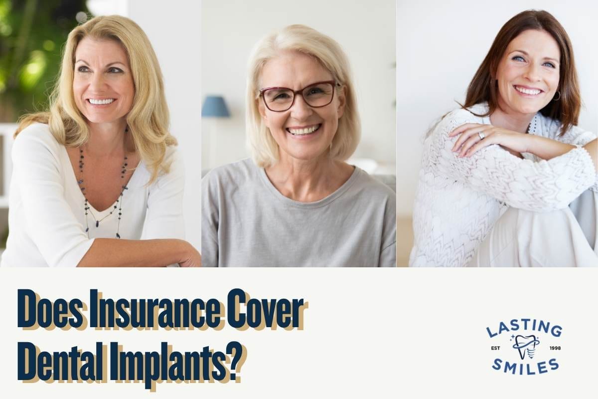 Does insurance cover dental implants? Lasting Smiles