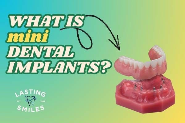 Featured image for “Mini Dental Implants in Irvine: A Complete Guide to Faster, Affordable, and Minimally Invasive Tooth Replacement”