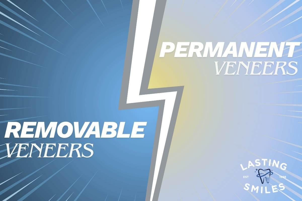 Featured image for “Removable Veneers vs. Permanent Veneers: Which Option Is Right for Your Smile?”